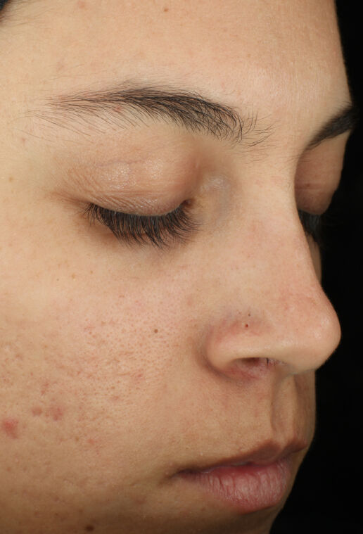 Complexion Clarifying Serum | Clarifying Face Serum | ZO Skin